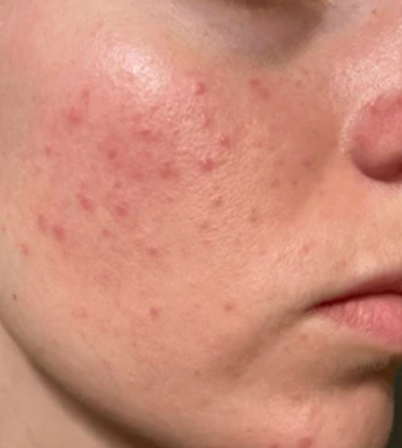 Before using Valittu - Maia