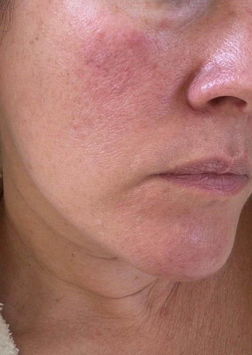 Before using Valittu - Megan K.