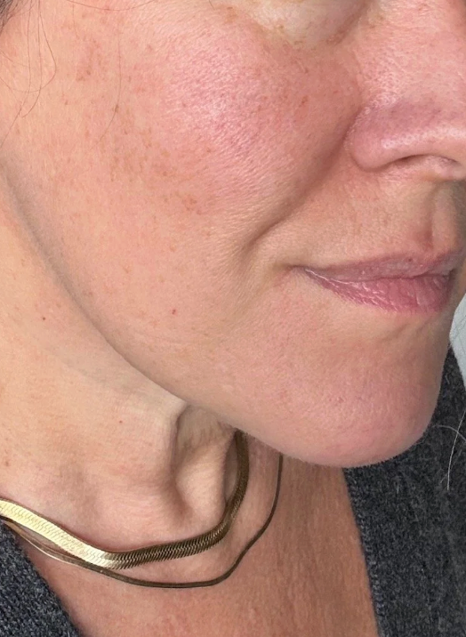 After using Valittu - Megan K.